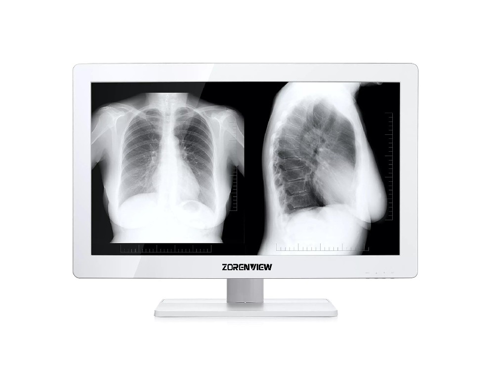 高清醫(yī)療監(jiān)視器