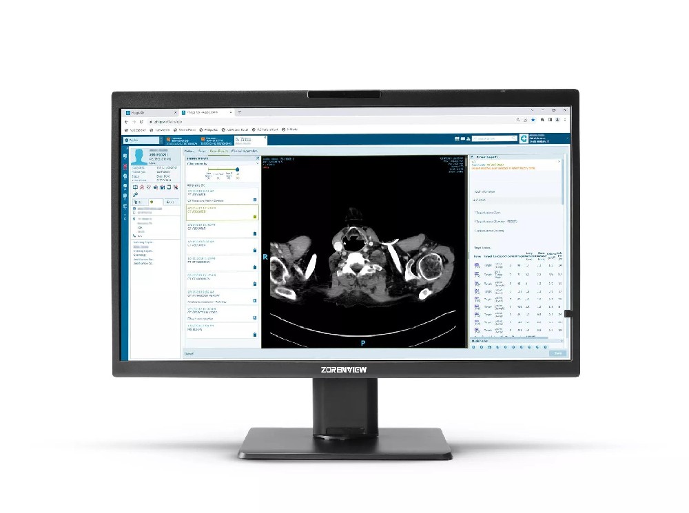 4K醫(yī)療監(jiān)視器