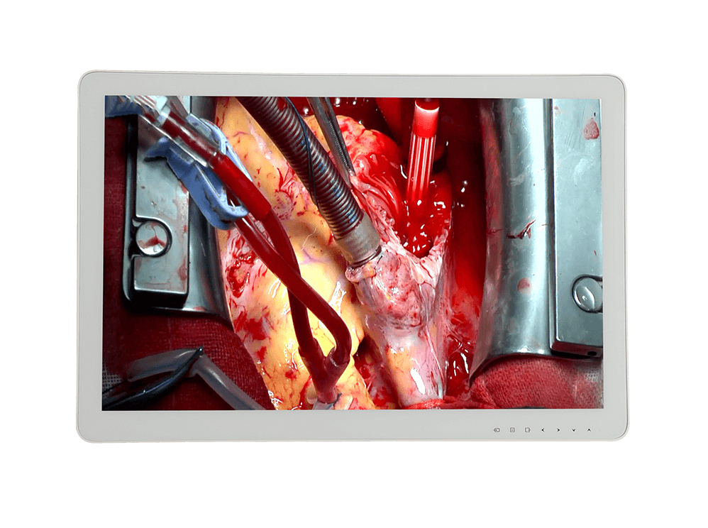 DSA手術(shù)醫(yī)用顯示器